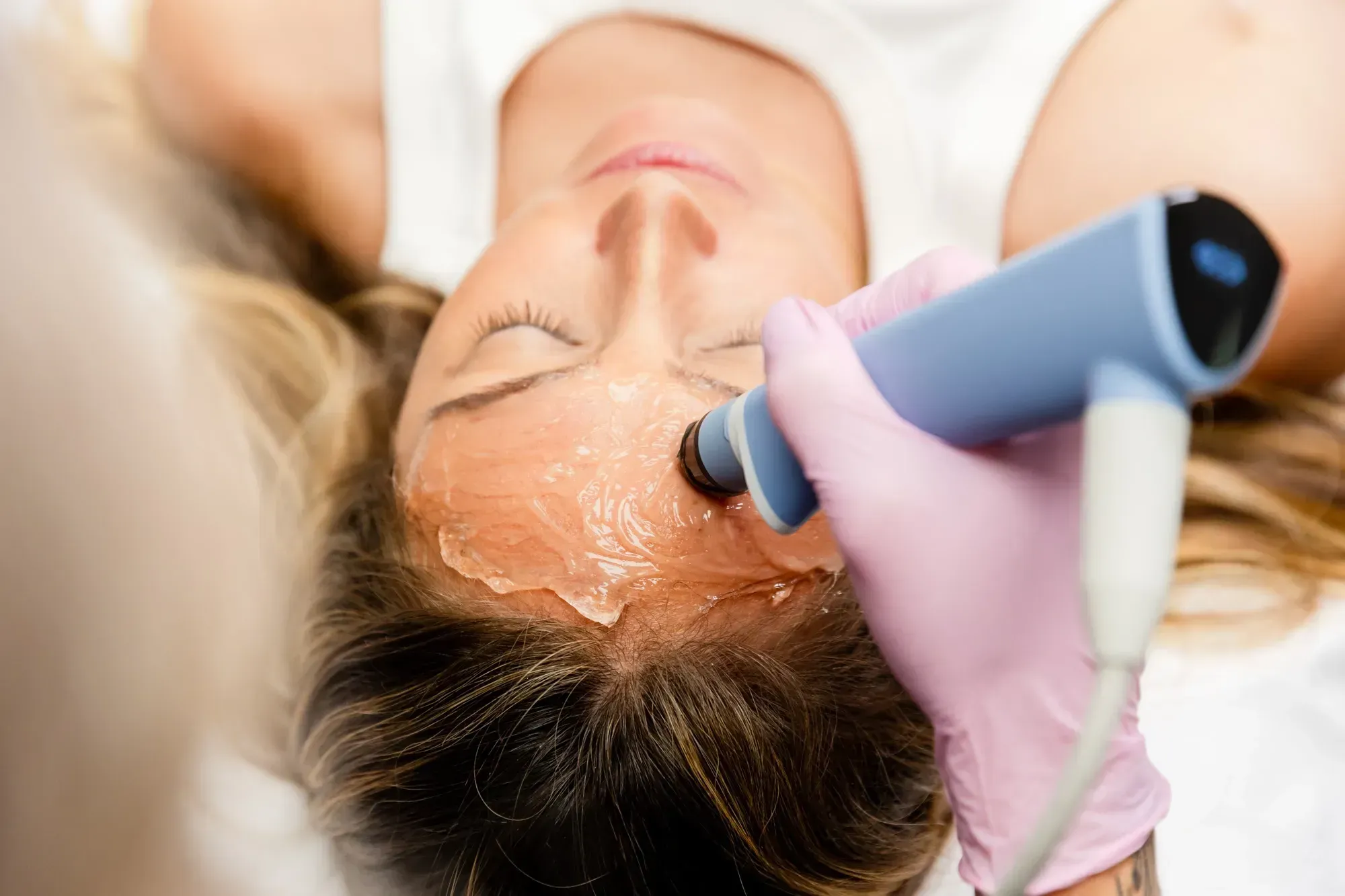Exion Treatments in Crescent Springs, KY