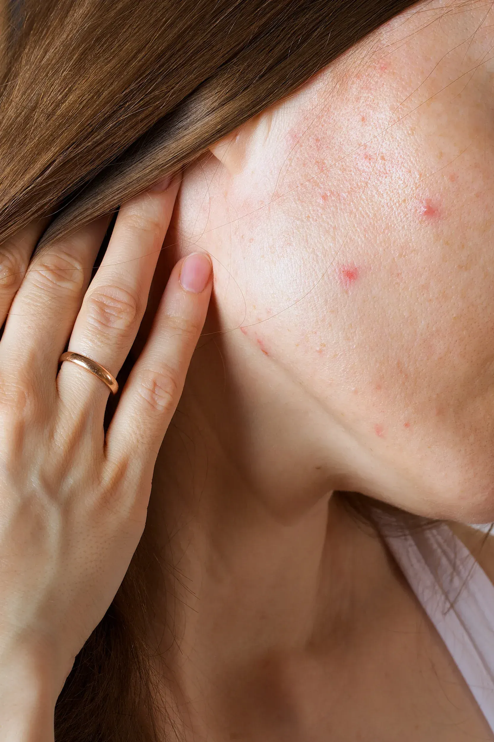 Woman examining acne scars and texture at Heritage Wellness & Med Spa Crescent Springs