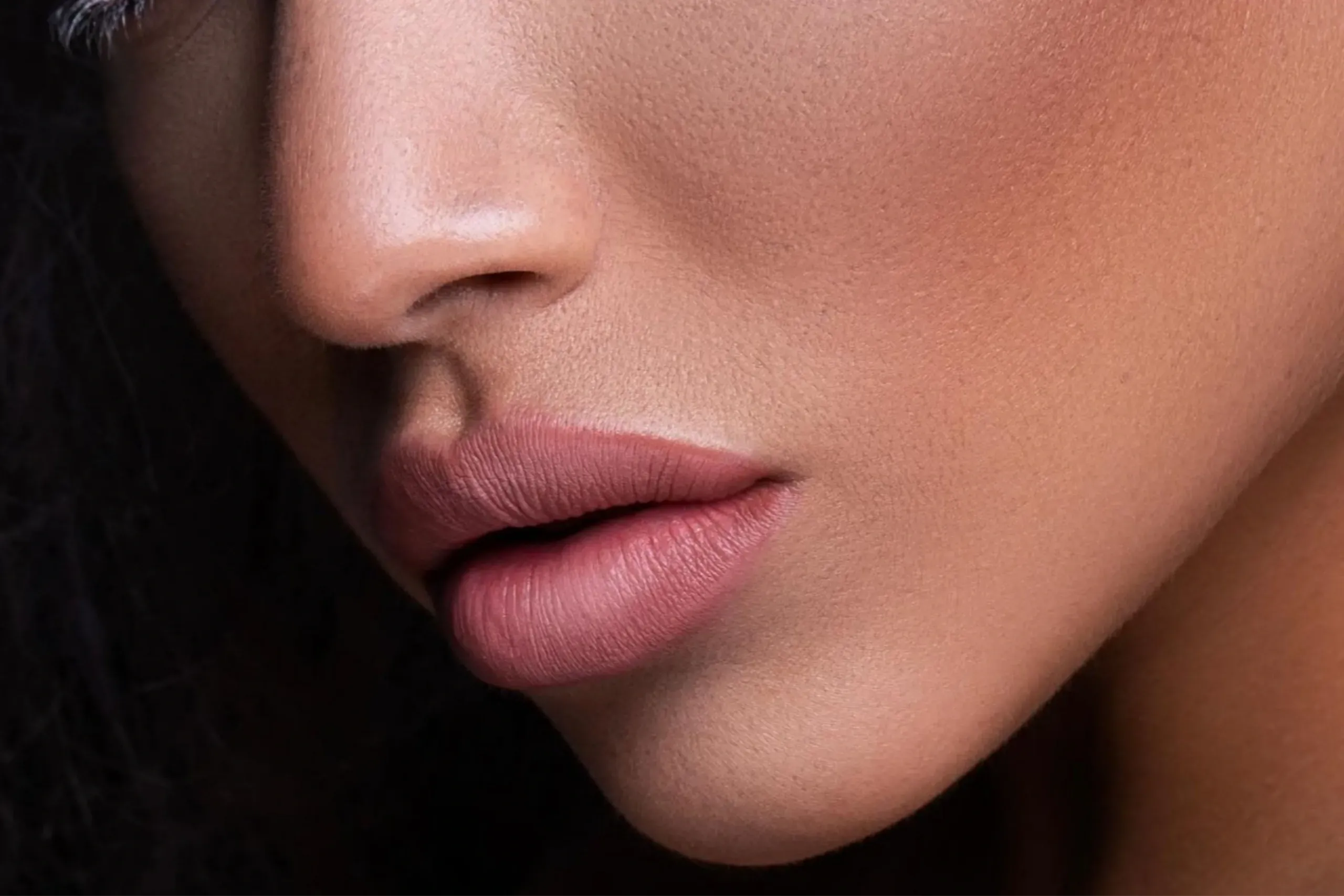 Lip Filler with Revanesse Versa+
