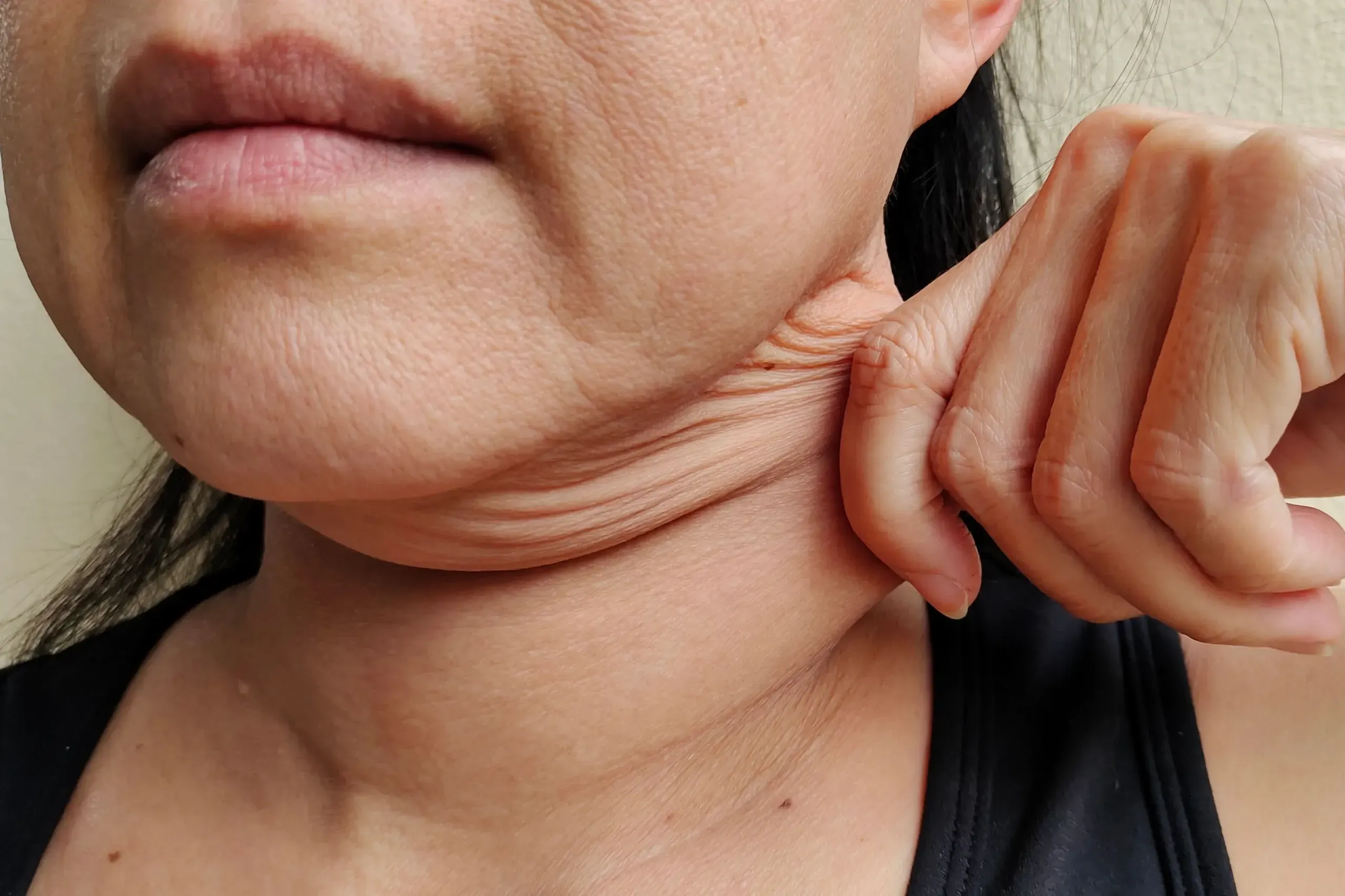 Lifestyle factors influencing skin laxity at Heritage Wellness & Med Spa Crescent Springs