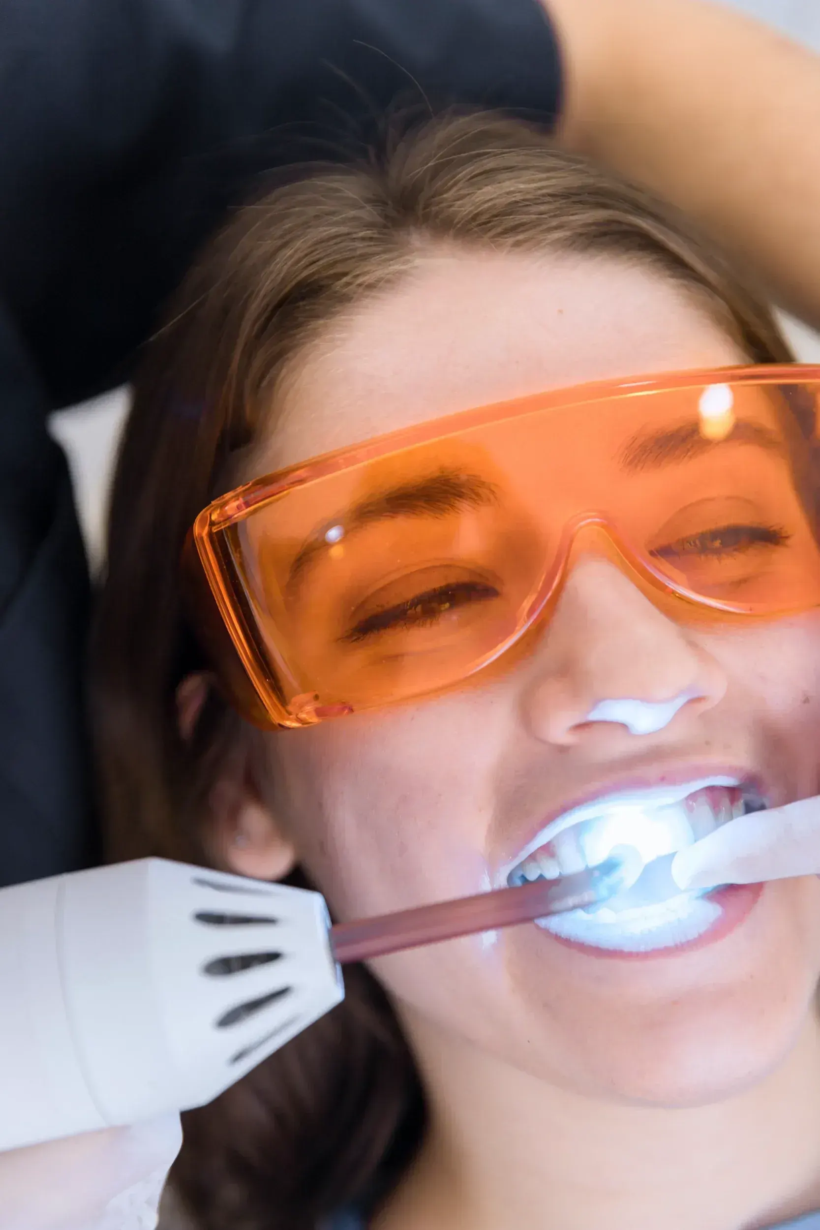Benefits of In-Office Teeth Whitening